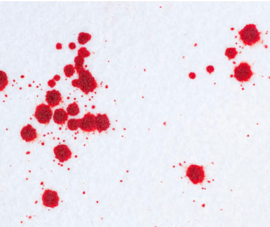 Accutane Nasal Dryness Is Real—Natural Comfort Can Help (Why Parents Love NOSE LUV)