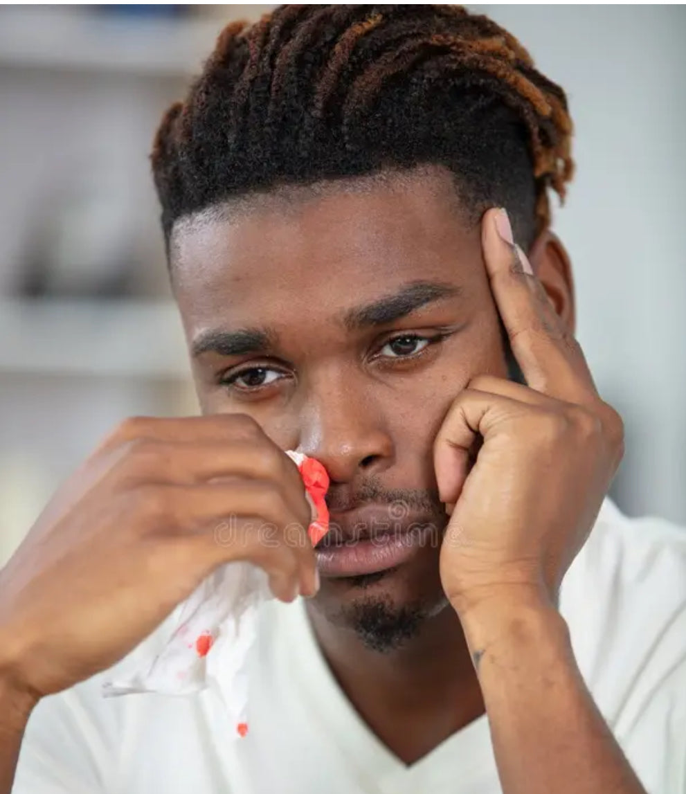 10 Natural Nasal Care Products That Calm and Prevent Accutane Nosebleeds